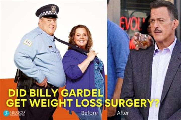 Did Billy Gardell Have Weight Loss Surgery- How Much Weight Did He Lose?