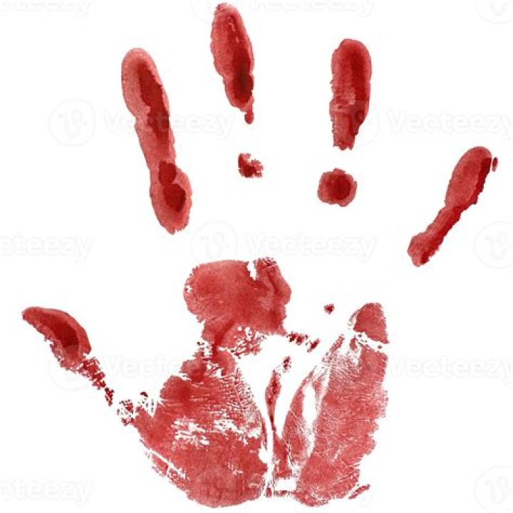 Hand Dryer Blade Tiktok Video Explained- Blood & Hand Cut Off- What Happened?