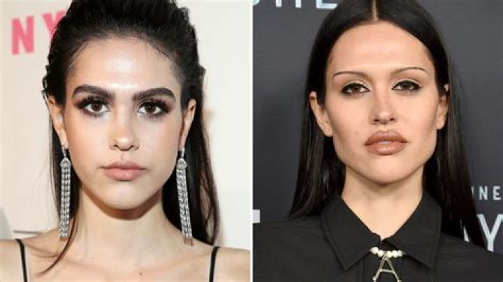 
Has Kelsey Darragh Had Plastic Surgery? 