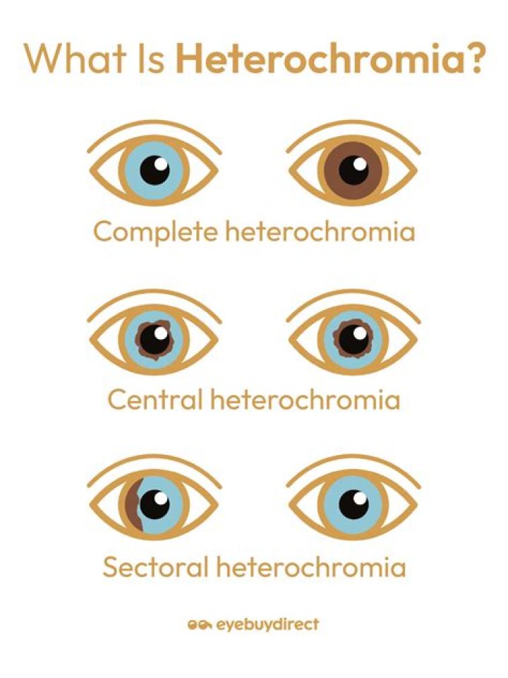 
Has Mila Kunis Heterochromia Iridum Cured? Illness And Health Update 2022 