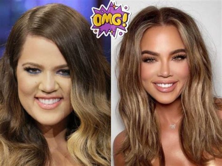 
Khloe Kardashian Before And After Her Brazilian Lift; Is It Real? 