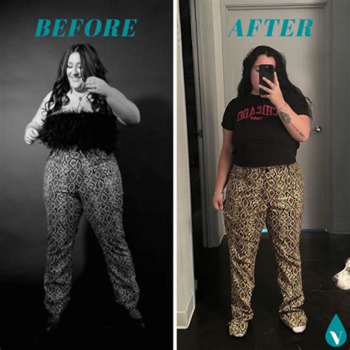 
Magda Szubanski Health Update: Weight Loss Before And After 