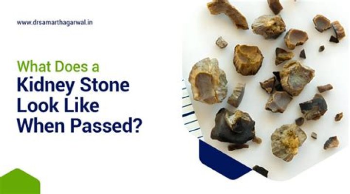 
Paul Westhead Had Kidney Stones In Winning Time, But It Is Based On Real Life? 