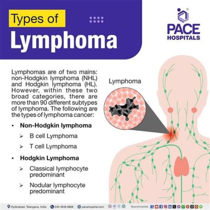 
What is lymphoma cancer? TikToker Ben Grosskopf receives support after revealing the saddening diagnosis 