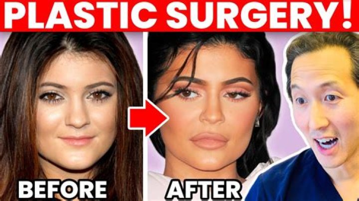 What Plastic Surgery Did Jania Meshell Get? Before And After Photos